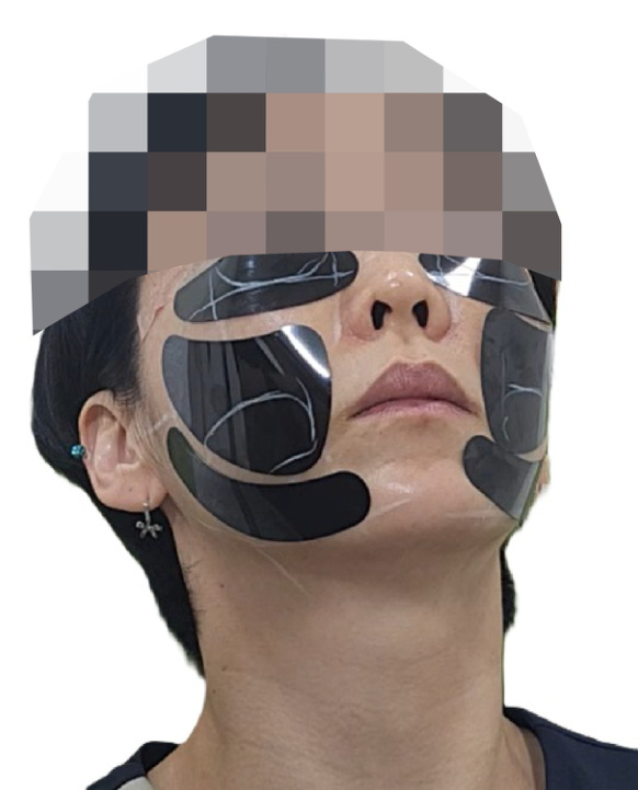 블랙다이아몬드 패치 부착