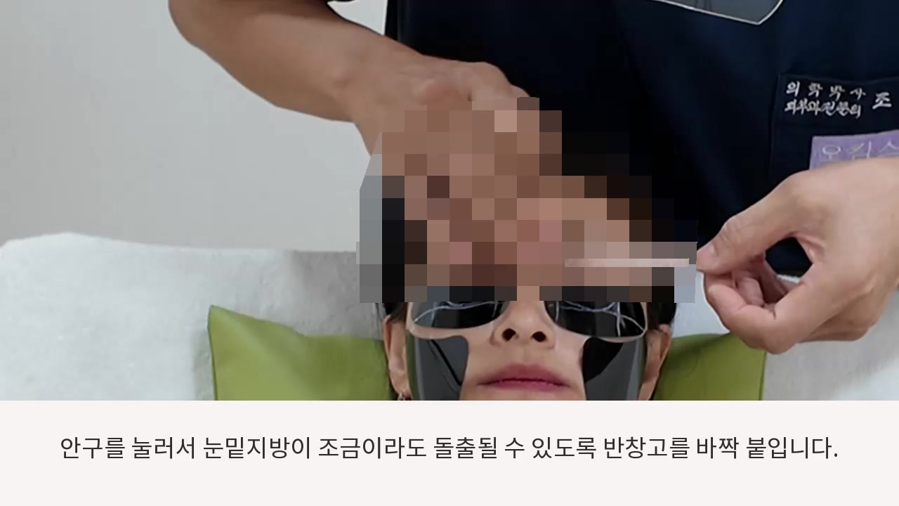 모자이크 처리된 패치 부착 시연 장면